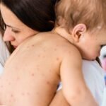 як виглядає вітрянка