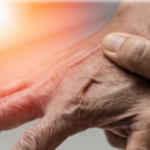 Полинейропатия