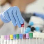 сечова кислота