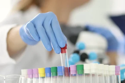 сечова кислота